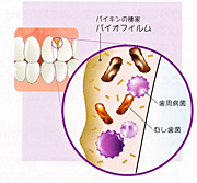 PMTCイメージ